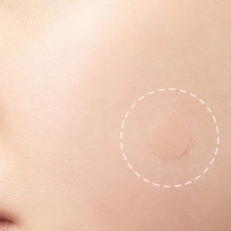 Skin Tag Removal Kit | Small & Standard Skin Tag Remover Device | Painless Skin Tag Remover